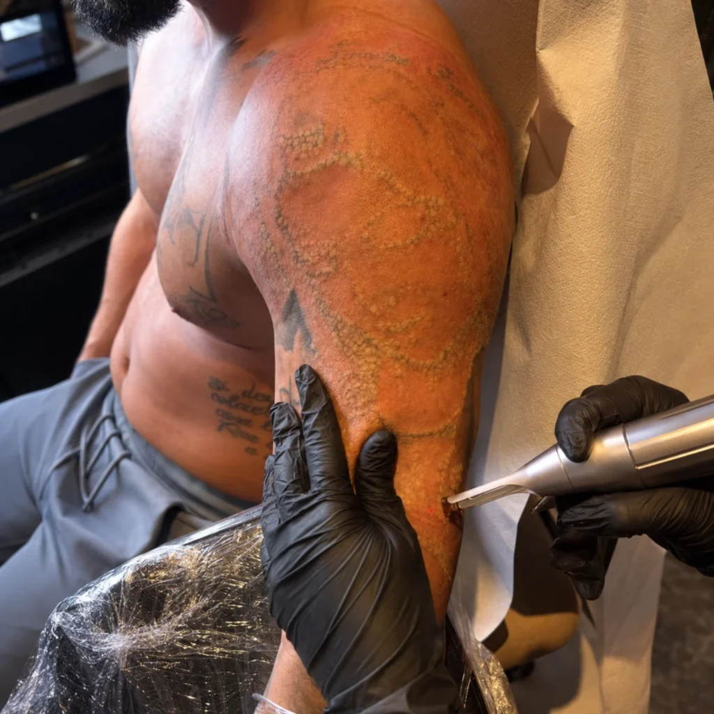 Marina Eliminacion Tattoo
