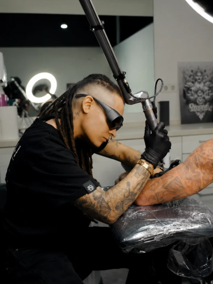 Pag eliminacion tattoos