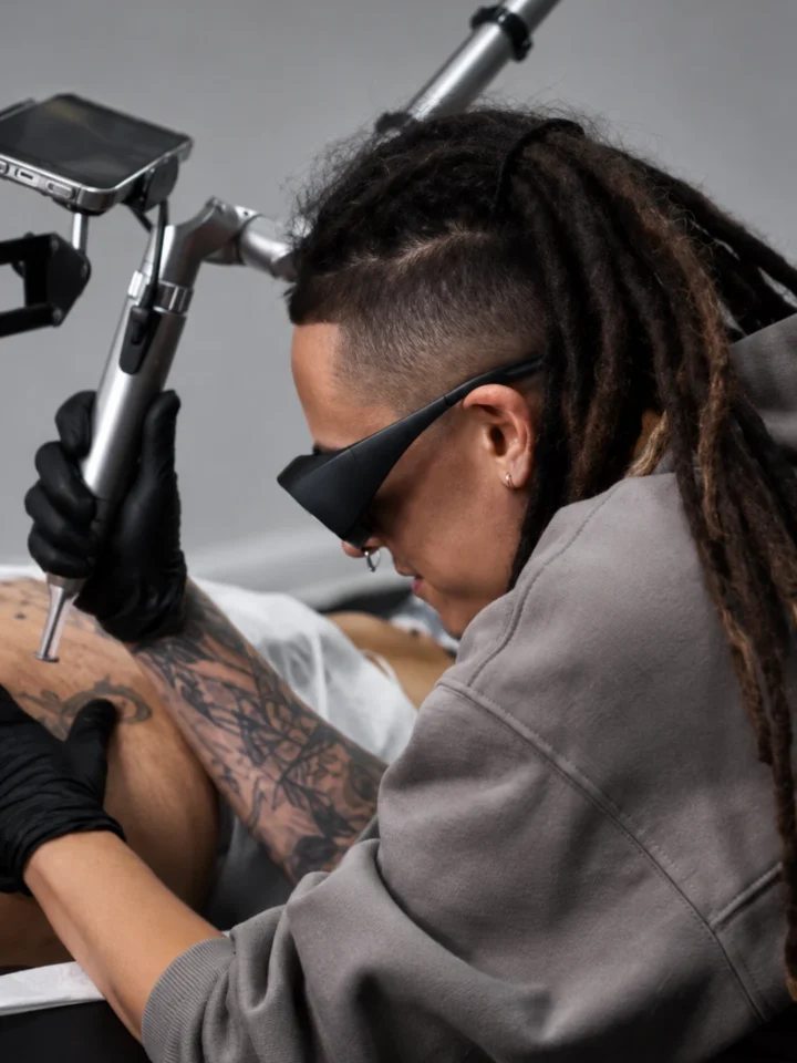 Pag eliminacion tattoos
