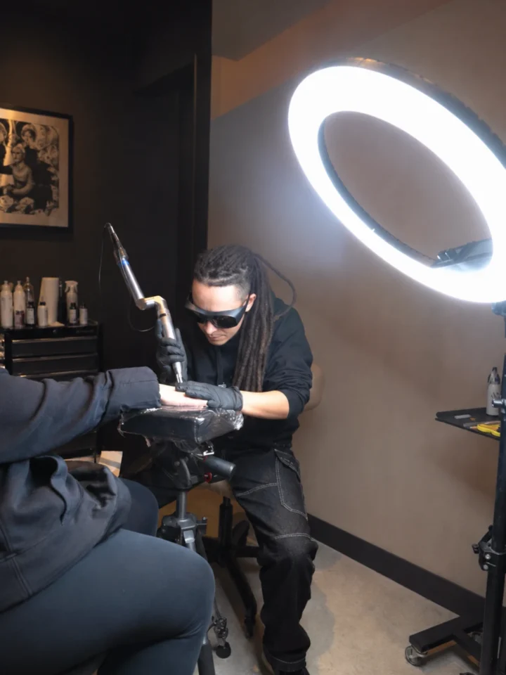Pag eliminacion tattoos