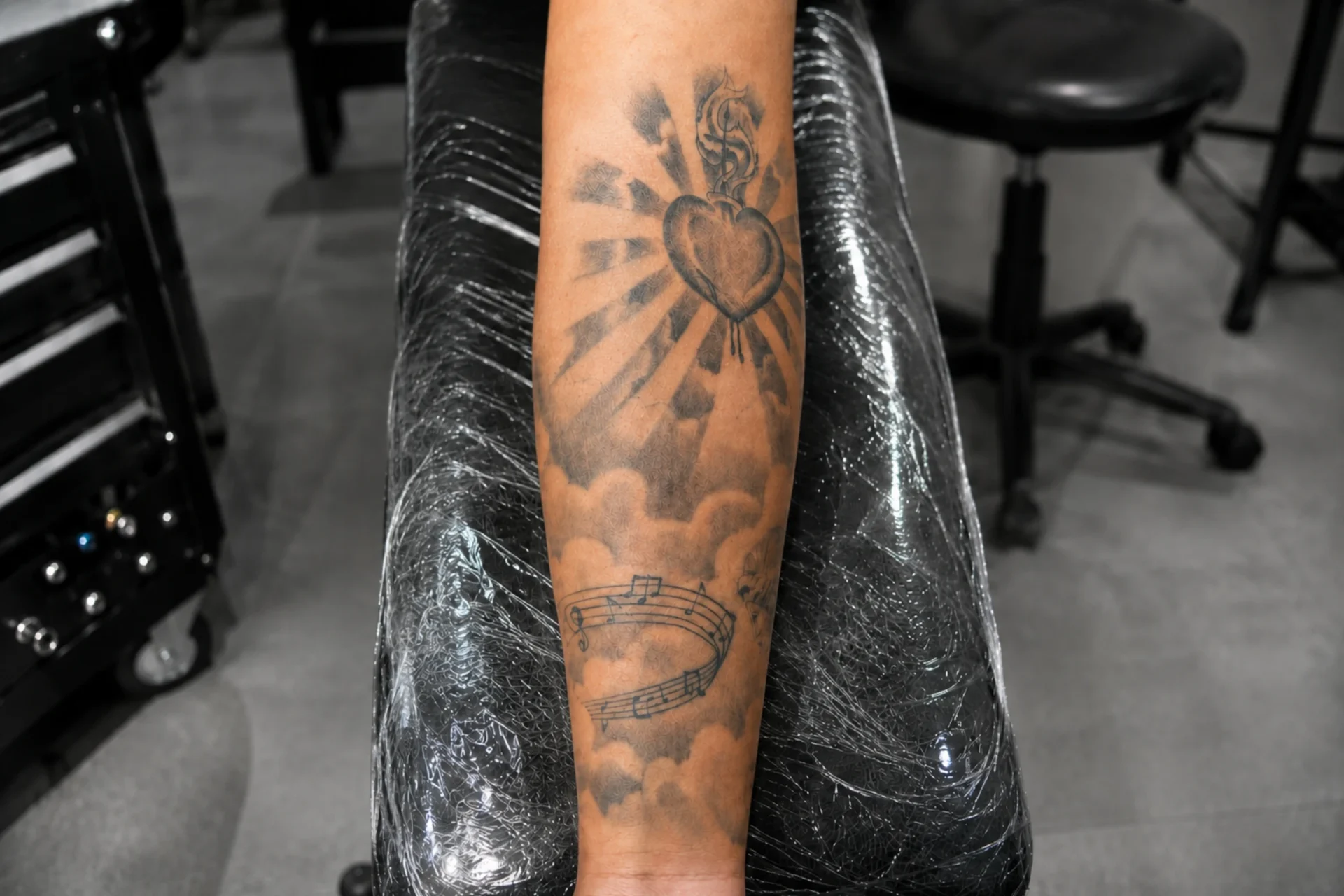 comparar eliminacion Tattoo